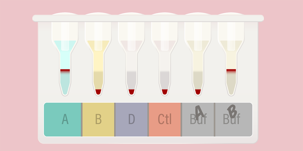 Illustration of an A negative result on a column agglutination blood typing test