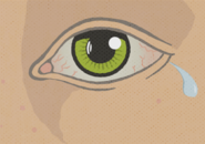Illustration of a teary, bloodshot eye