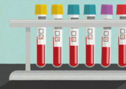 Illustration of five laboratory vials of blood samples